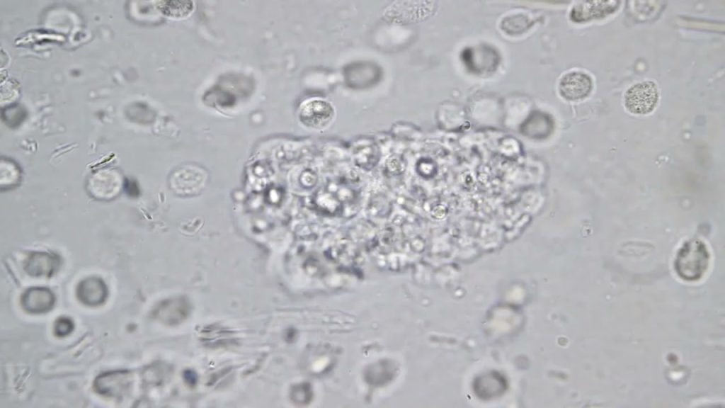 HiddenTruthBacteriaParasitesVirus