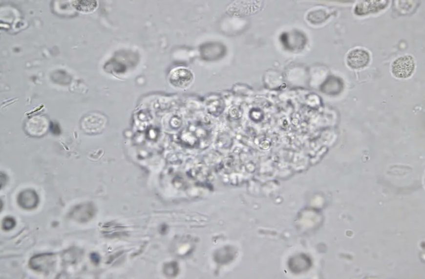HiddenTruthBacteriaParasitesVirus