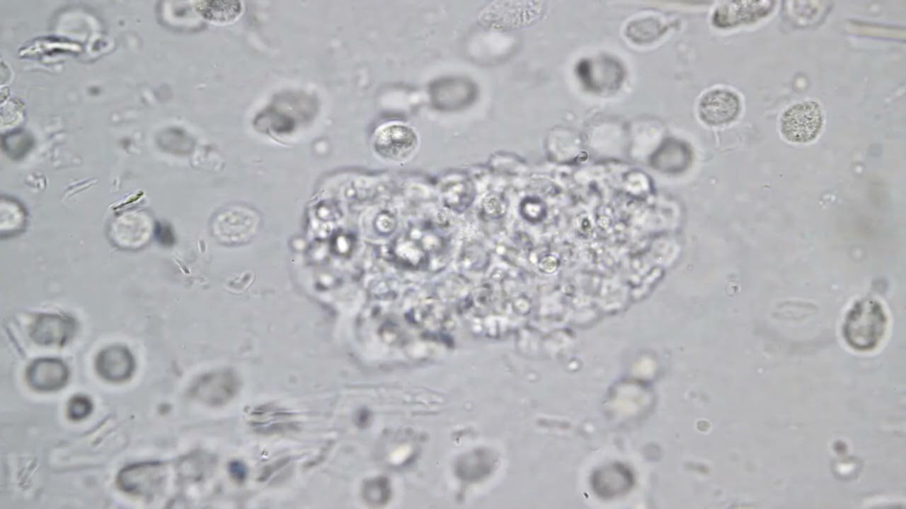 HiddenTruthBacteriaParasitesVirus